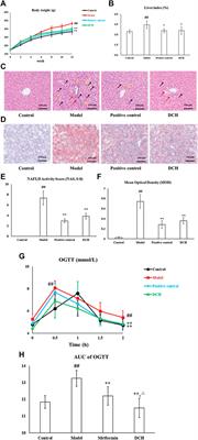 Da-Chai-Hu Decoction Ameliorates High Fat Diet-Induced Nonalcoholic Fatty Liver Disease Through Remodeling the Gut Microbiota and Modulating the Serum Metabolism